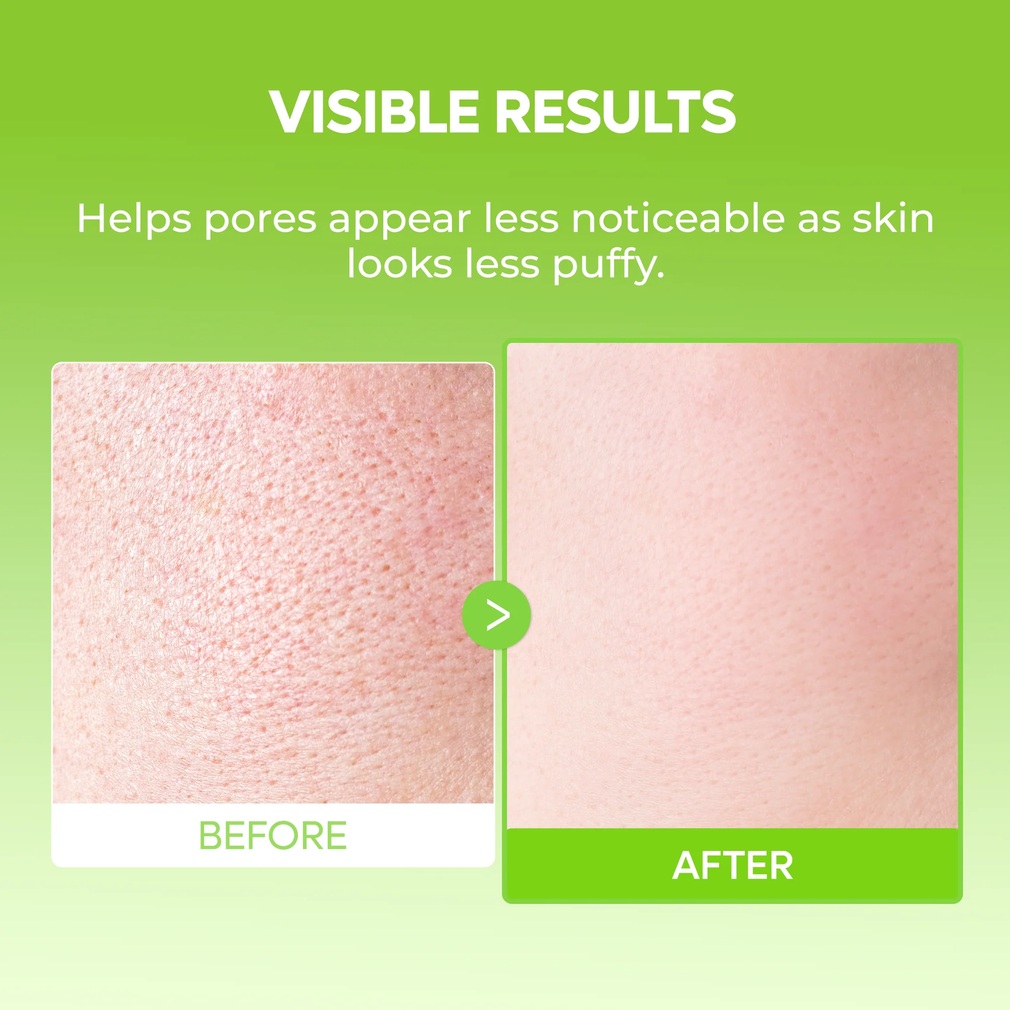 CACTOX De-Puffing Pore Tox Gel Mask 4EA - Image 7