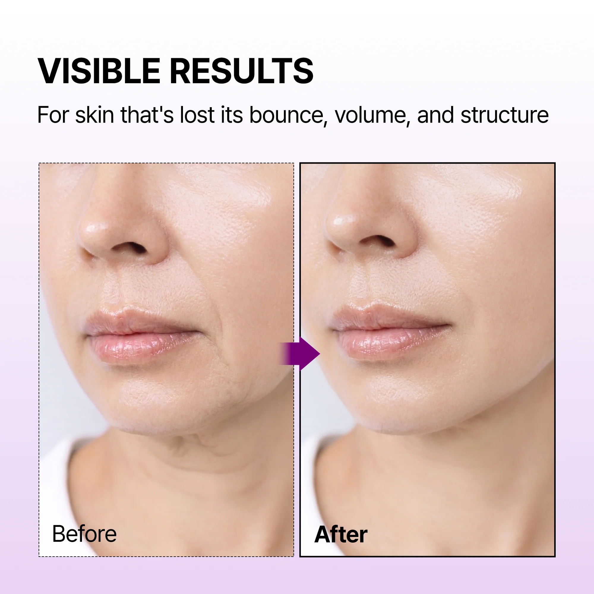 Calcium Bonding Facial Cream - Image 3