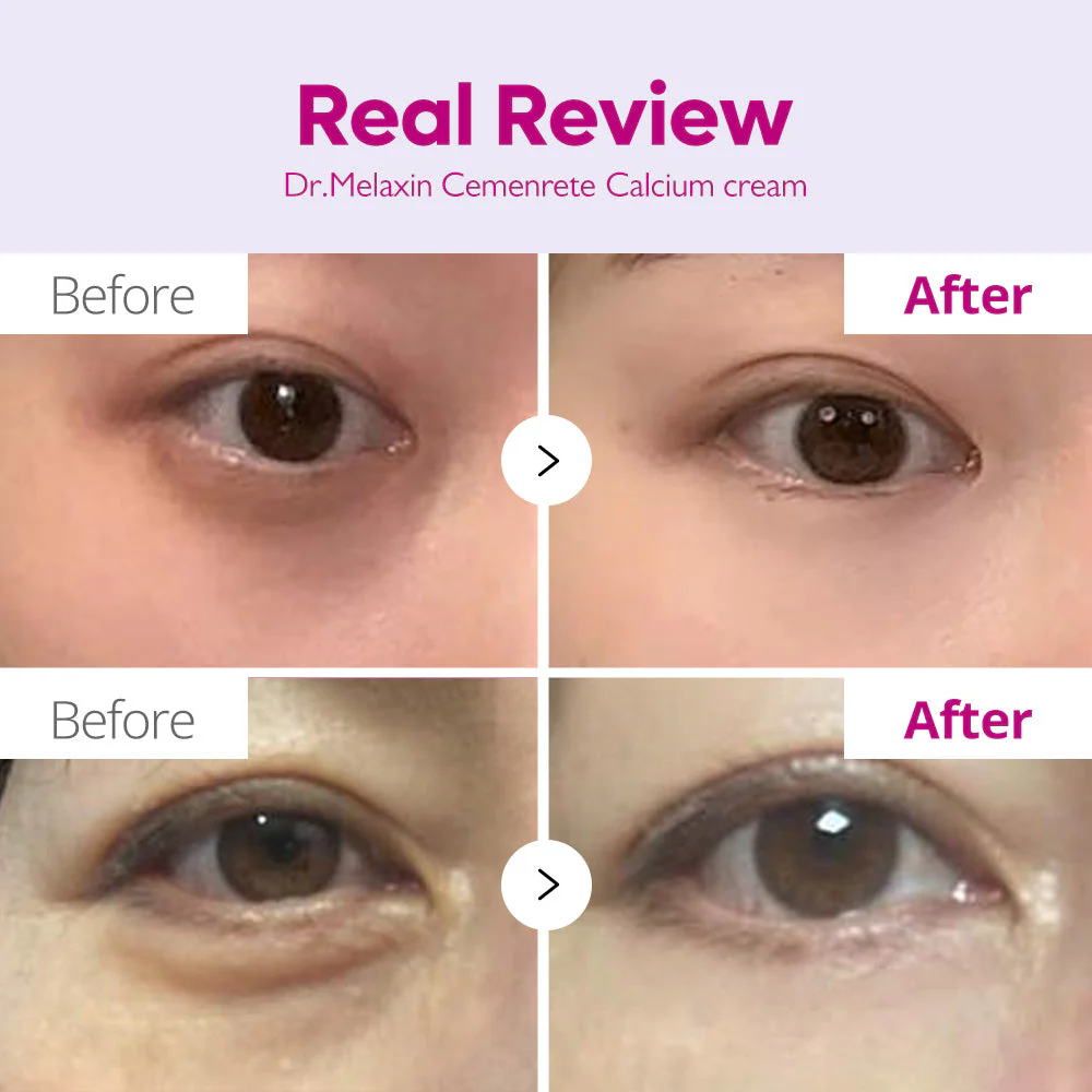 Cemenrete Calcium Intense Cream - Image 4