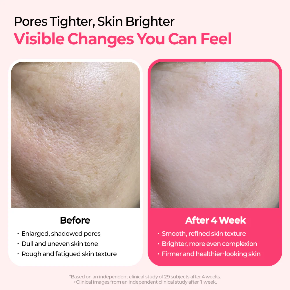 Cemenrete Cyano Pink Spicule Serum - Image 5