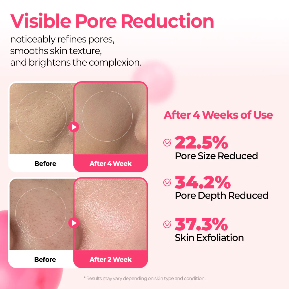 Cemenrete Cyano Pink Spicule Serum - Image 8