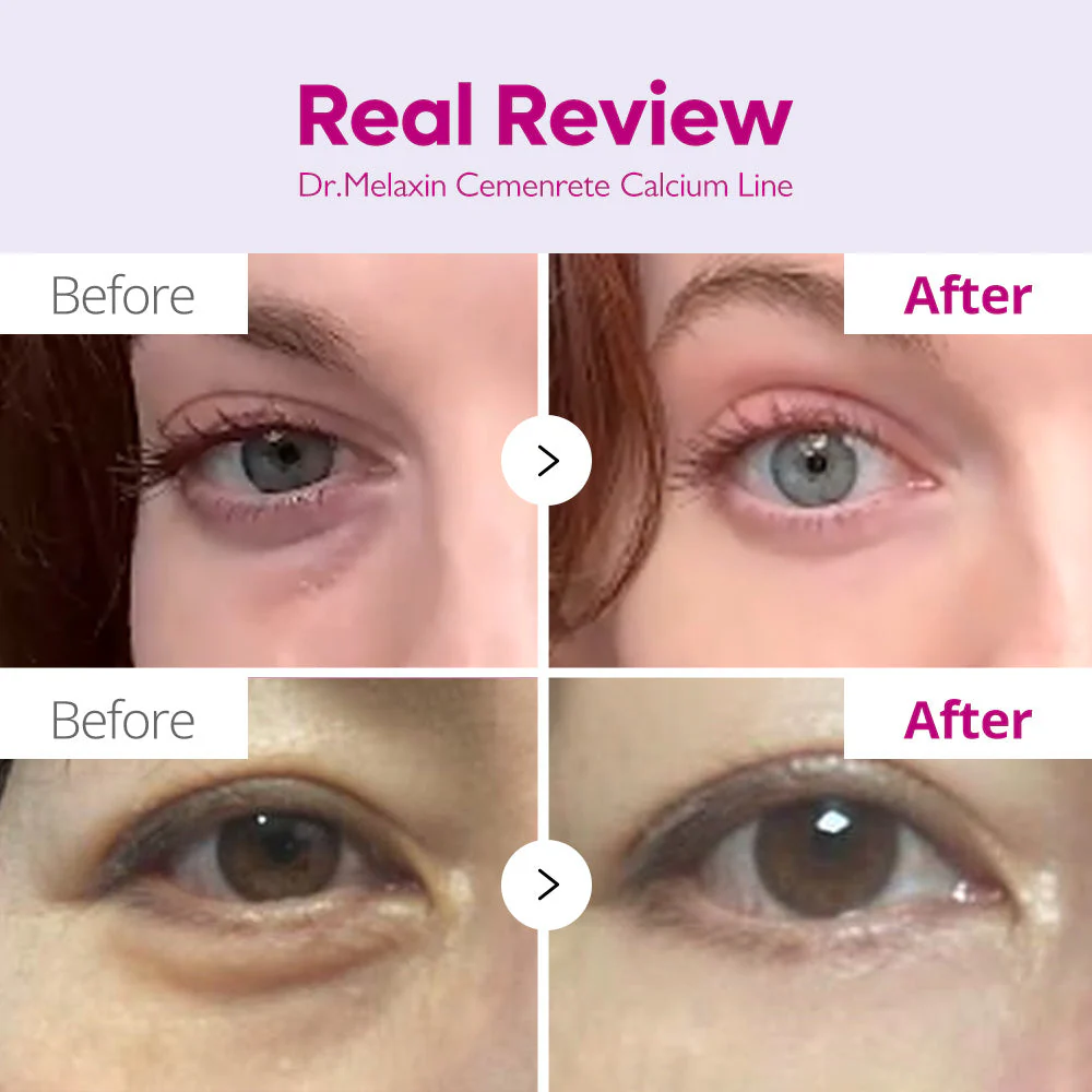 Cemenrete Collagen Calcium Eye Care Line - Image 6