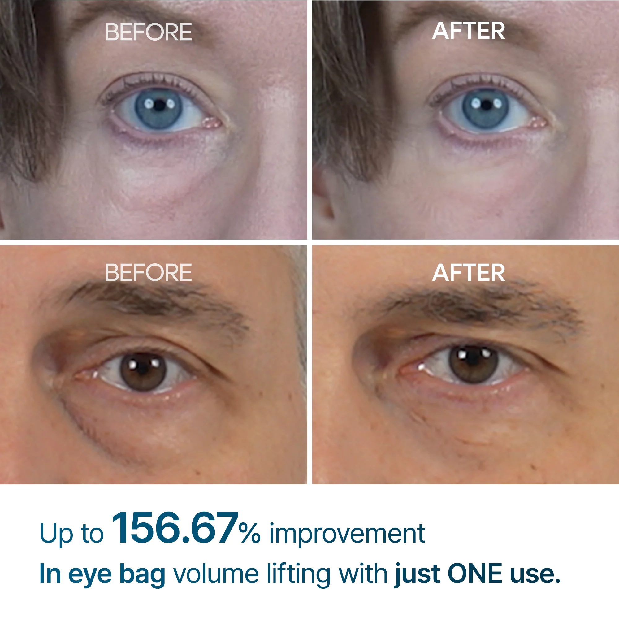 [TikTok Viral Bestseller] Eyephalt eyebag cream - Image 4