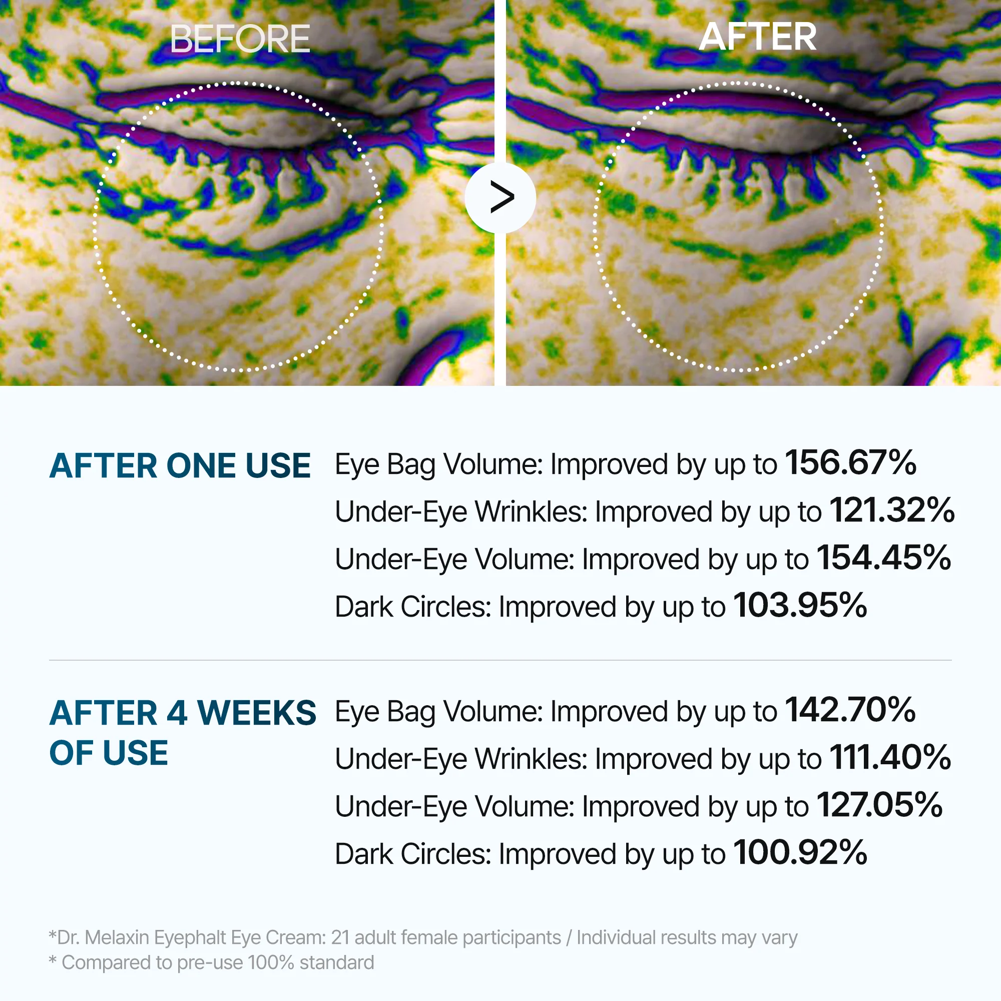 [TikTok Viral Bestseller] Eyephalt eyebag cream - Image 6