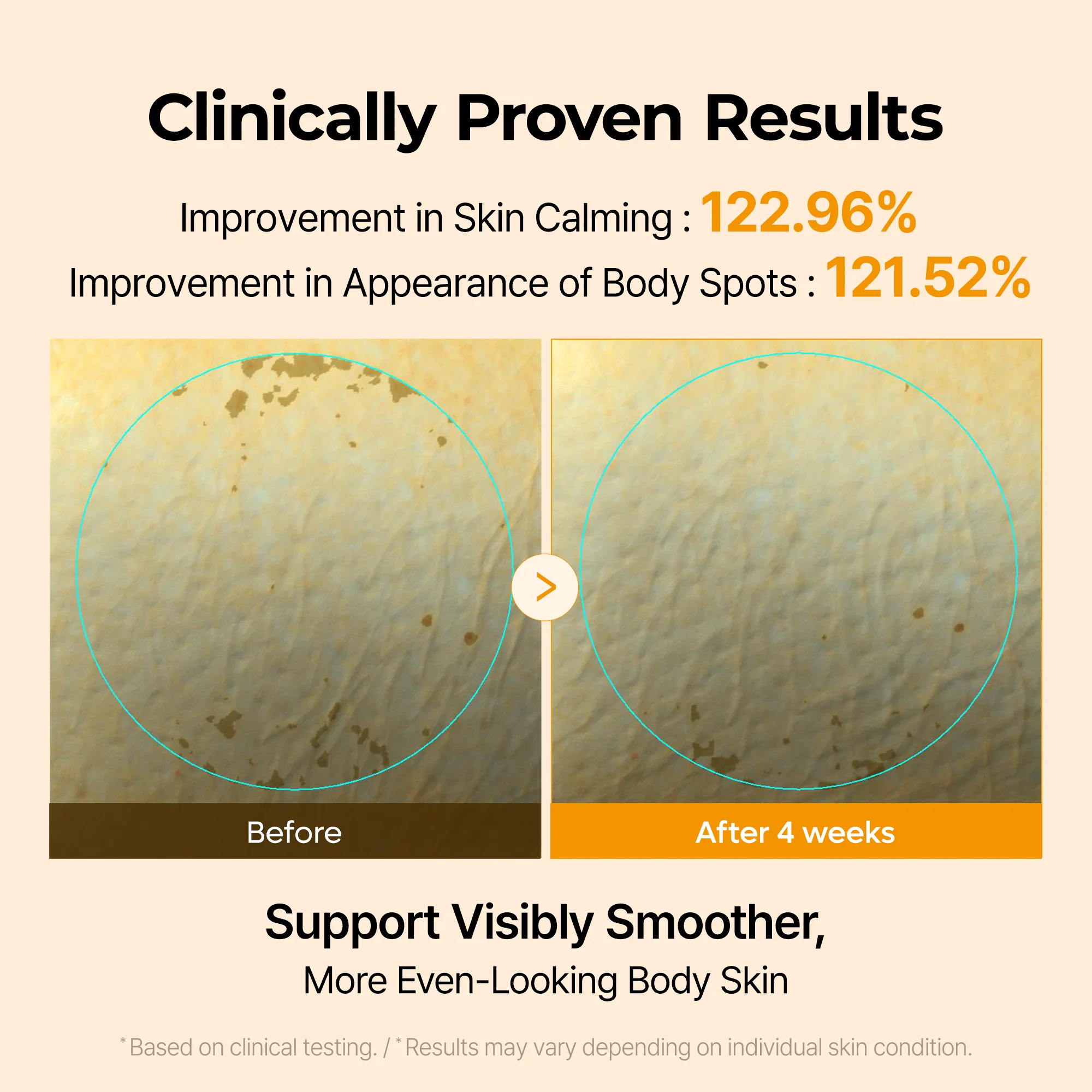 Kojic Acid Turmeric Capsule Body Cream - Image 3