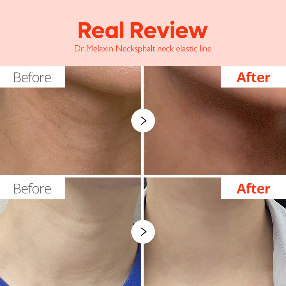 Necksphalt ECM Neck Tightening Line - Image 7