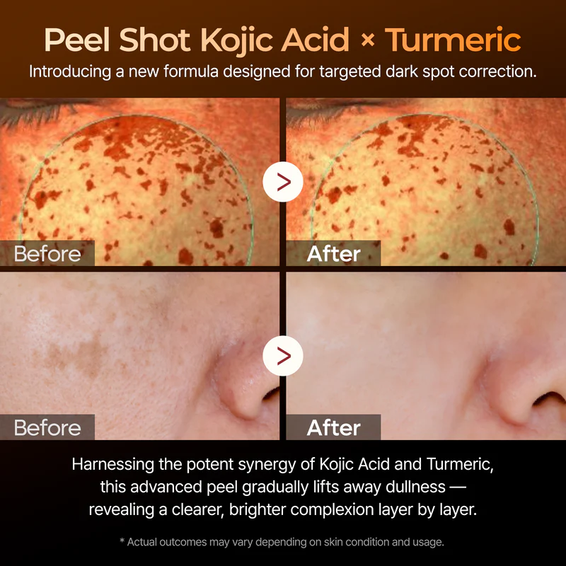 Peel Shot Kojic Acid Turmeric Serum - Image 3
