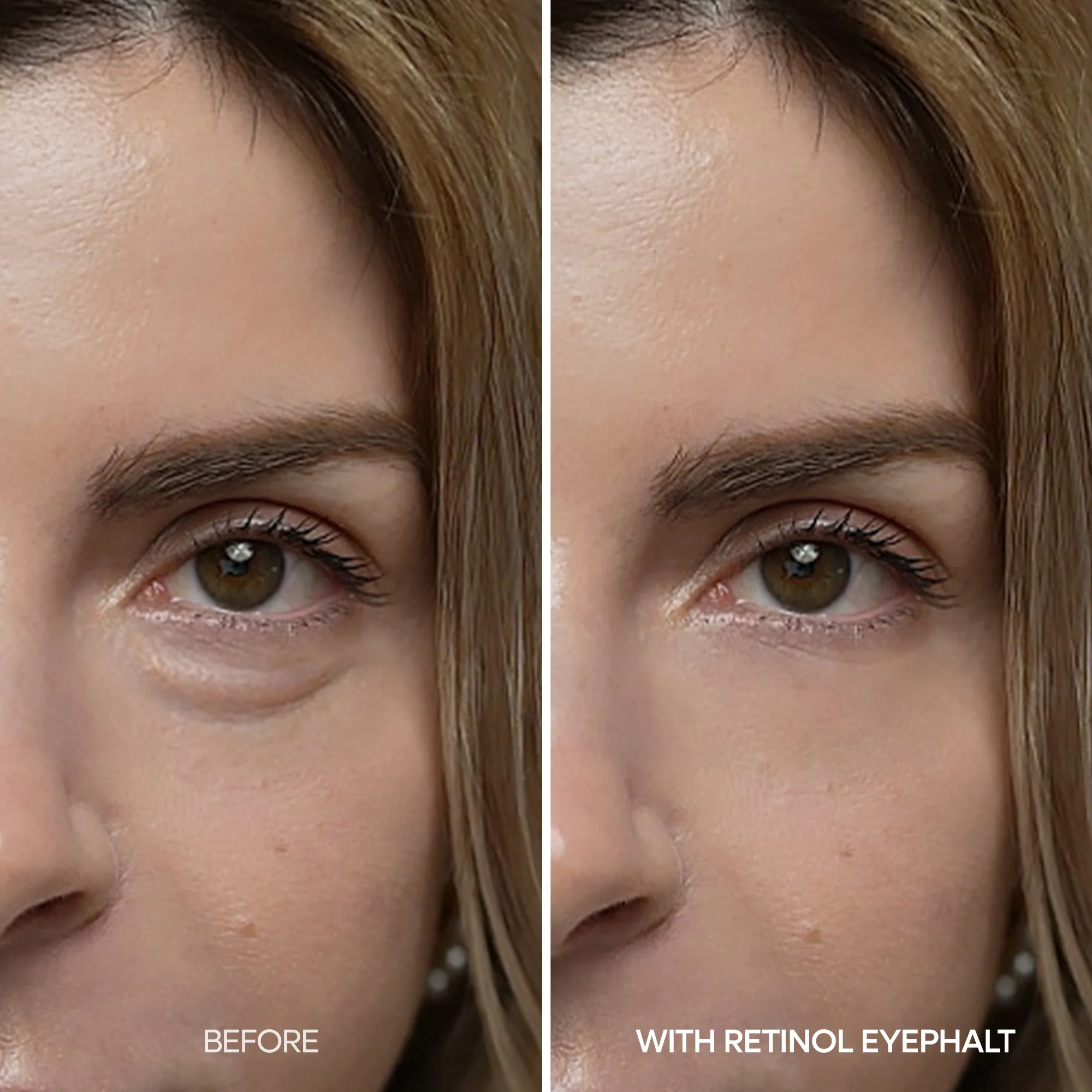 Retinol Eyebag Cream - Image 4