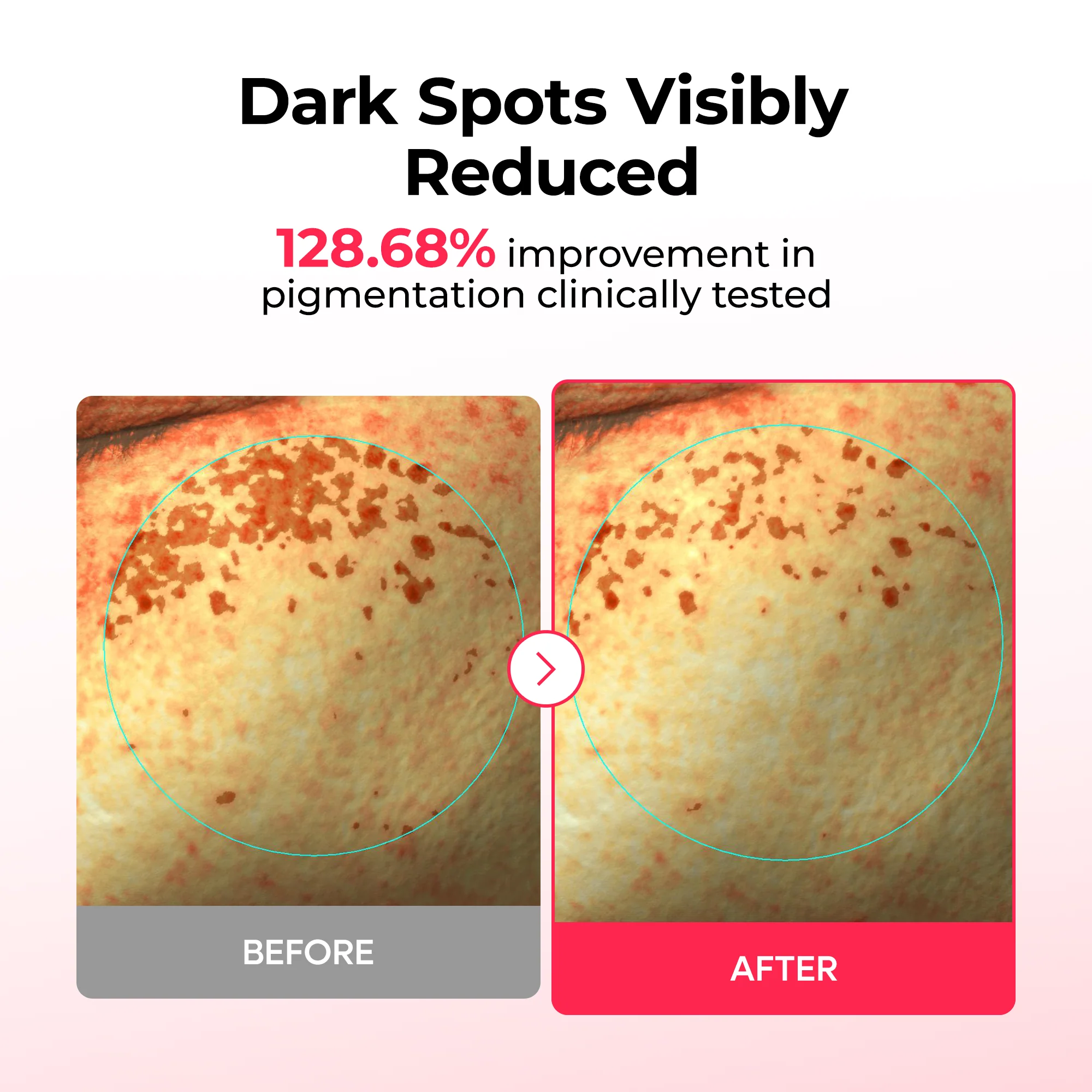 TX Astaxanthin Dark Spot Care Hydrogel Mask 4EA - Image 3