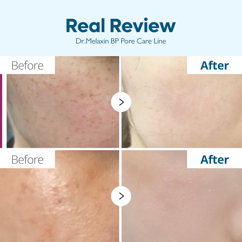 TX Freckle Care Line - Image 5